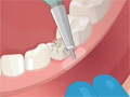 Online Game Operate Now: Dental Surgery